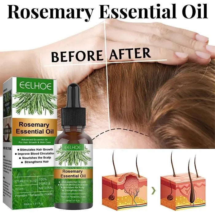 EELHOE Rosemary Moisturizing Conditioning Oil Anti-Breakage Nourishing Scalp Hair Growth Conditioning Oil